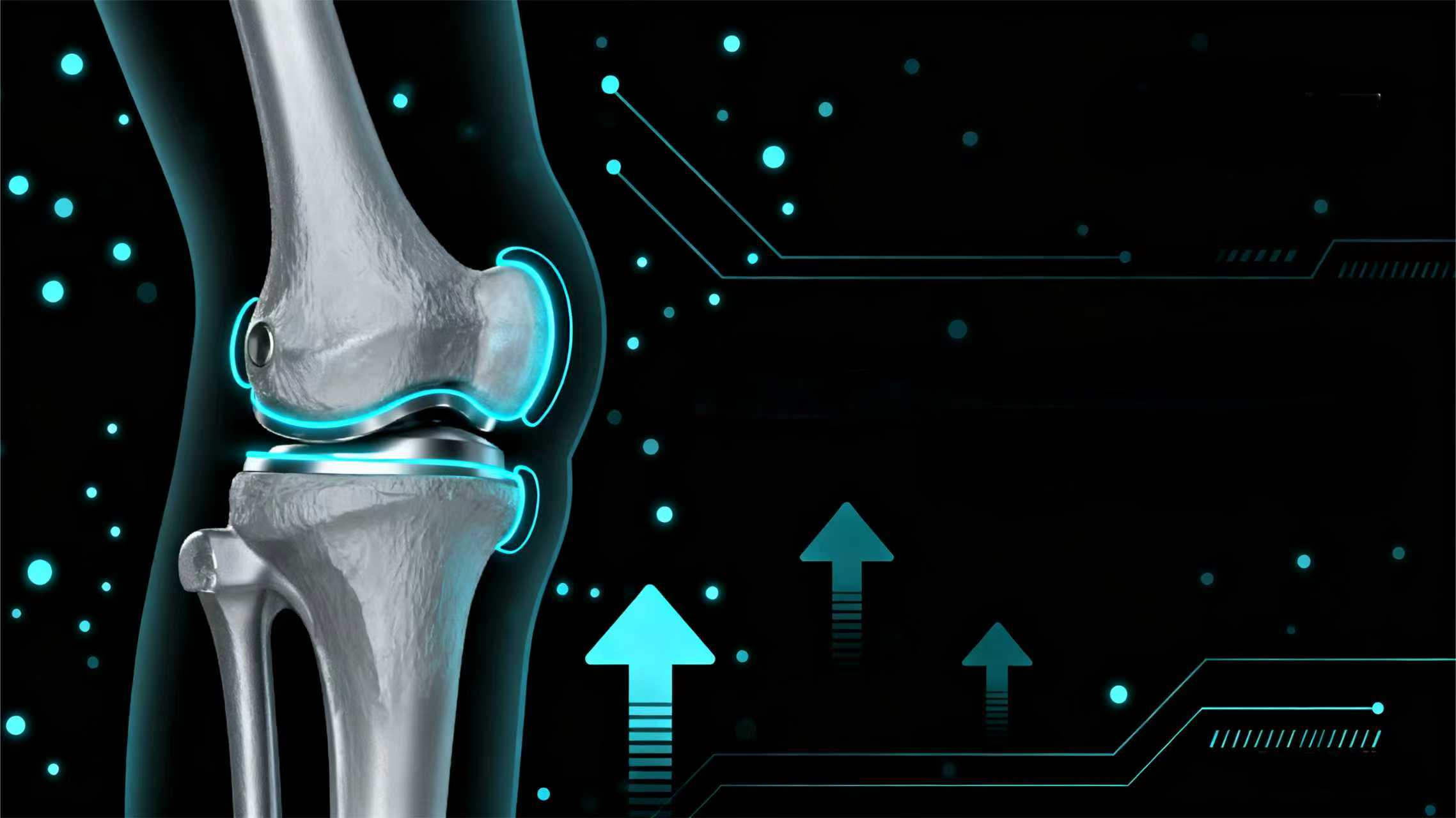 Precision-Empowered Knee Replacement Surgery! Shandong Liangyi's TKA-CW Surgical Instrument Set Makes Its Grand Debut
