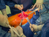 DAA Muscle Retractor